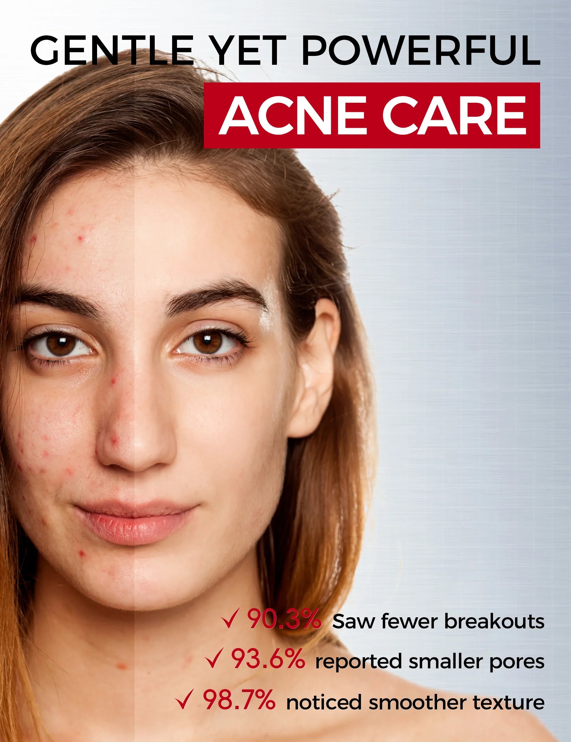 Salicylic Acid Acne Serum