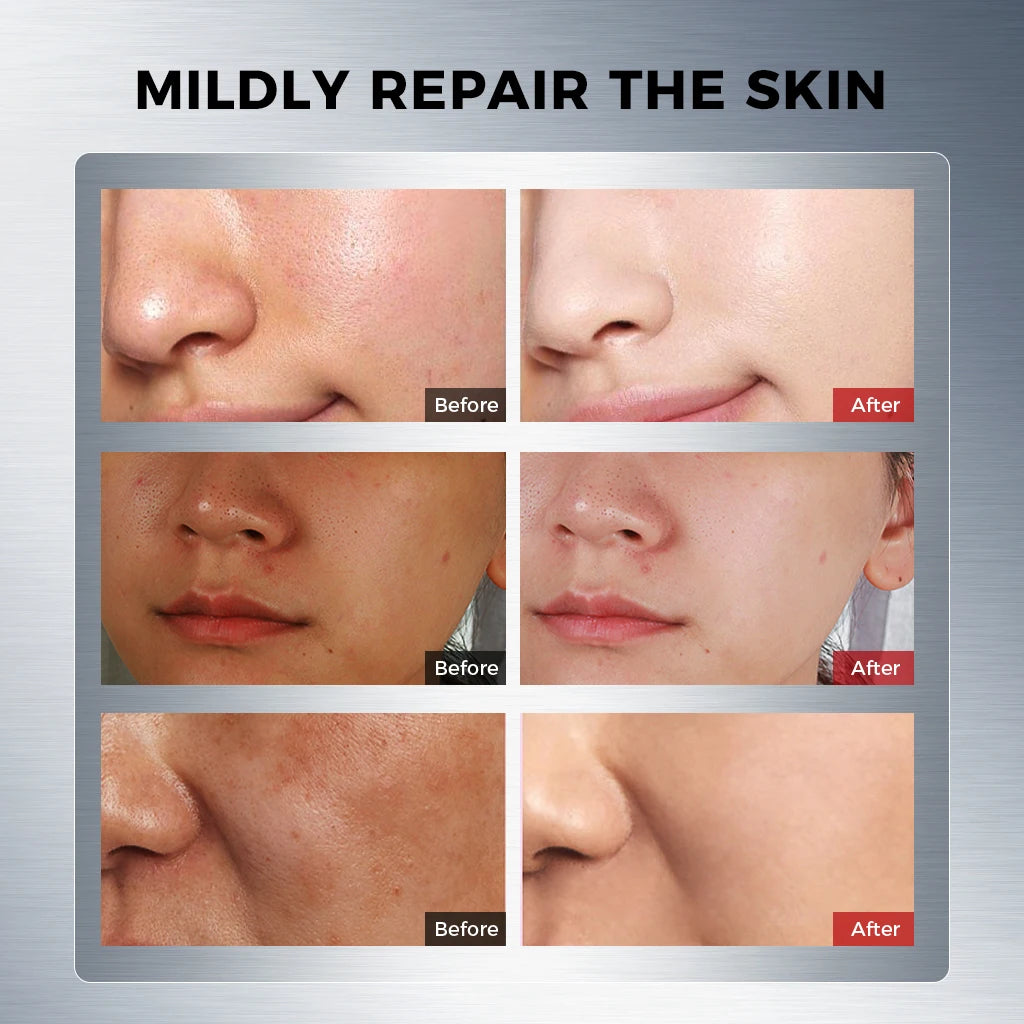 Whitening Spot Lightening Essence single-use ampoules 1.5ml x 20