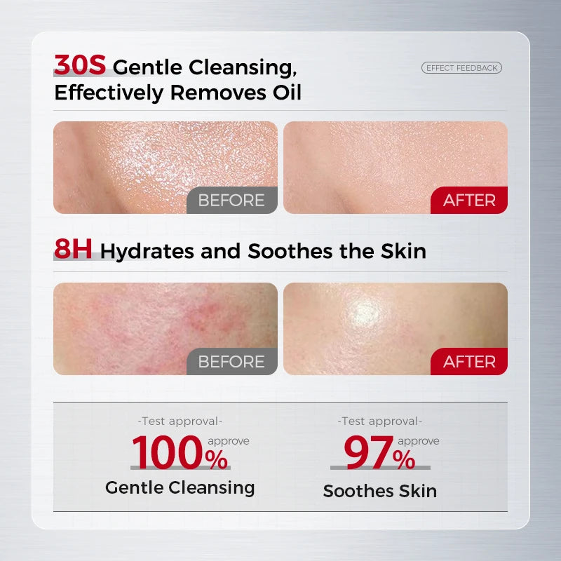 Amino Acid Cleansing Foam for Sensitive Skin