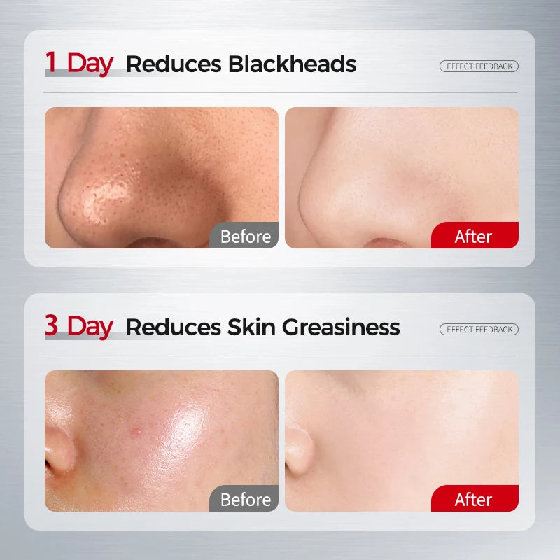 Amino Acid Facial Cleanser with Salicylic Acid