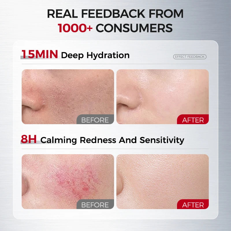 NING DERMOLOGIE Hydrating & Soothing System - Toner, Lotion, Cream