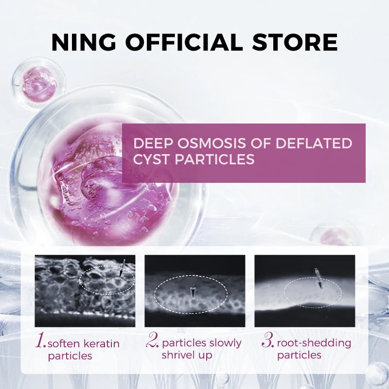 Lifting & Tightening Eye Essence with Zinc Fermented Yeast, Peptides & Retinol Palmitate