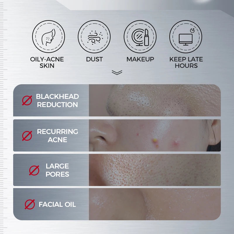 Amino Acid Facial Cleanser with Salicylic Acid