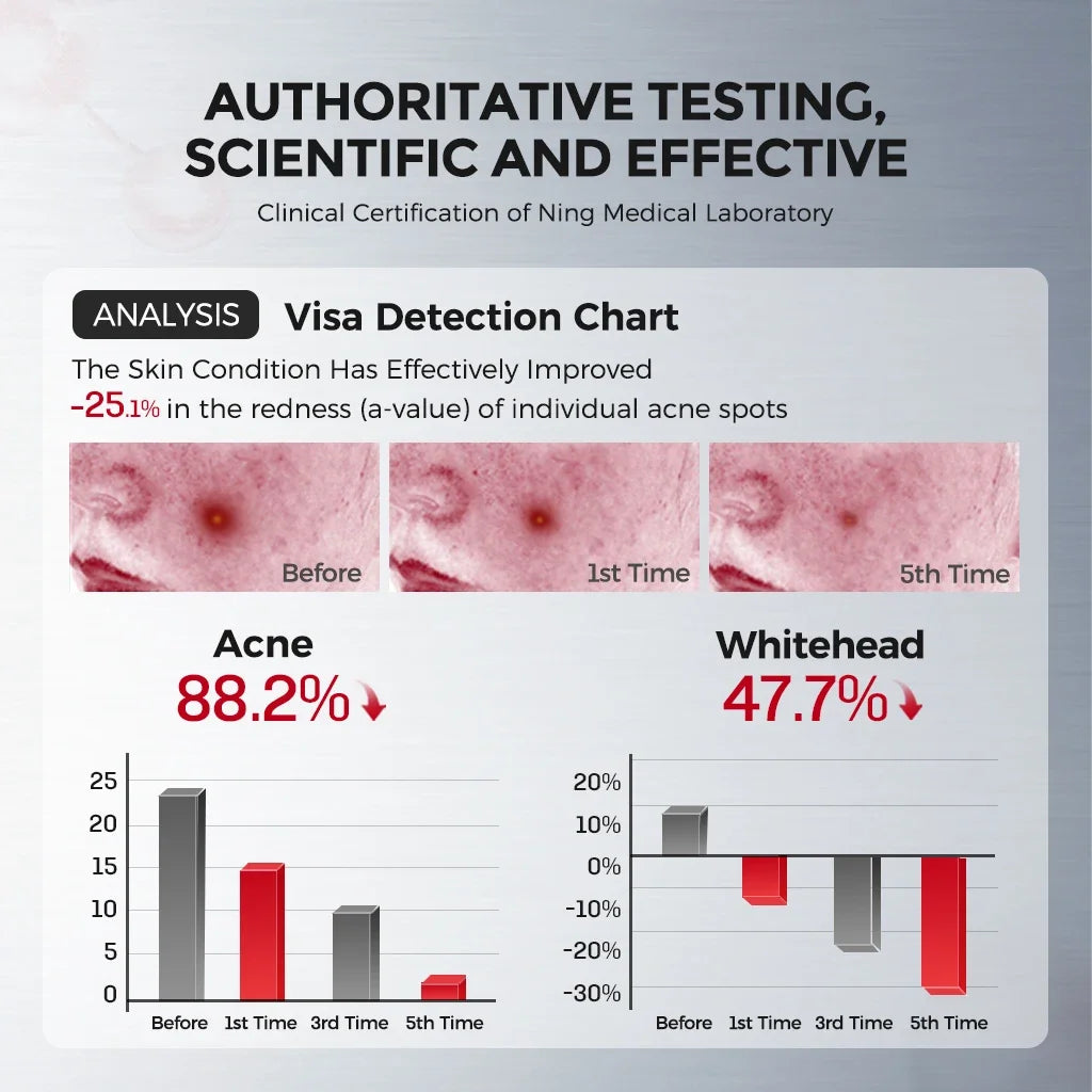 Anti-Acne Clarifying Facial Mask 10 pieces