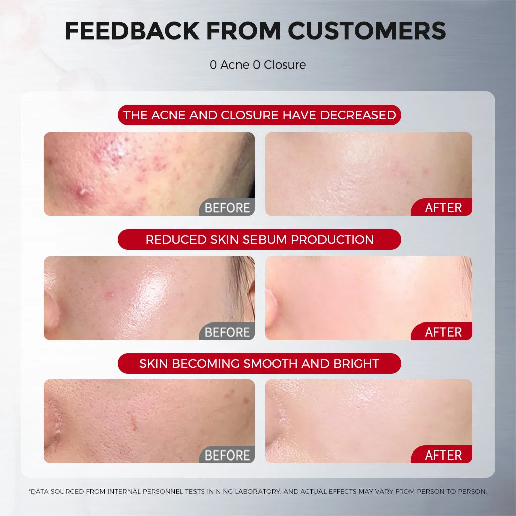 Whitehead Removal Toner