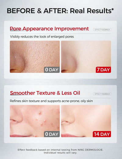 2% Salicylic Acid Serum 30ml