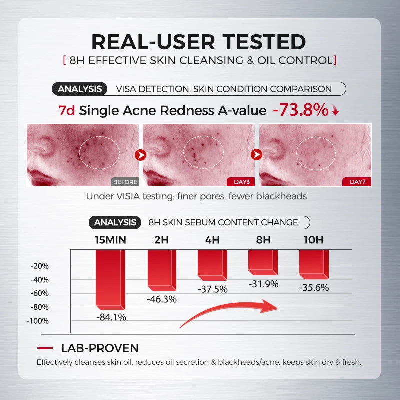 Amino Acid Facial Cleanser with Salicylic Acid