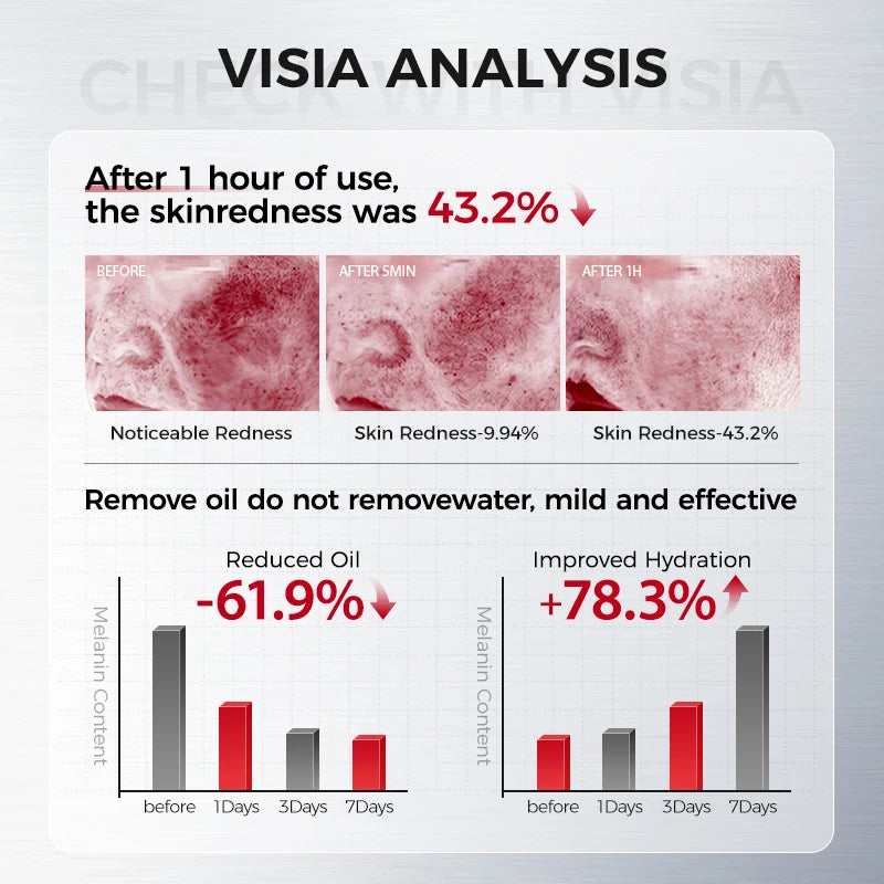 Amino Acid Cleansing Foam for Sensitive Skin