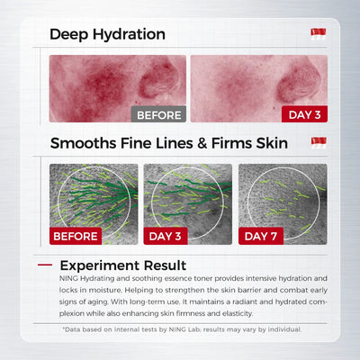 Hydrating & Soothing System - Toner, Lotion, Cream