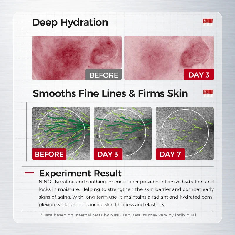 NING DERMOLOGIE Hydrating & Soothing System - Toner, Lotion, Cream