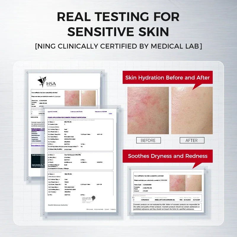 Amino Acid Cleansing Foam for Sensitive Skin