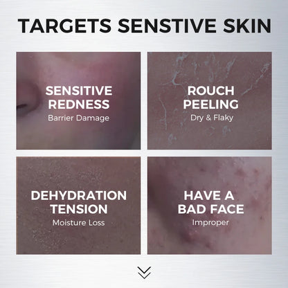 Amino Acid Cleansing Foam for Sensitive Skin