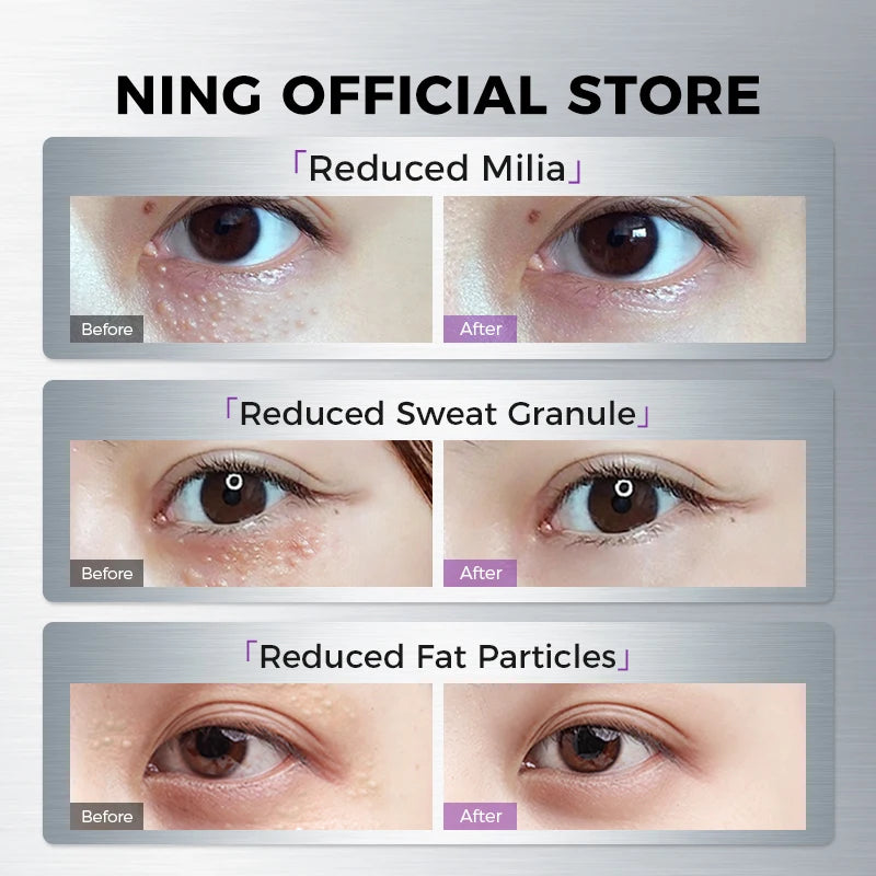 Lifting & Tightening Eye Essence with Zinc Fermented Yeast, Peptides & Retinol Palmitate