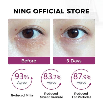 Lifting & Tightening Eye Essence with Zinc Fermented Yeast, Peptides & Retinol Palmitate