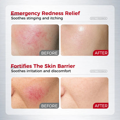 Hydrating Soothing Essence Cream